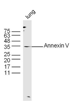 Annexin V Rabbit Polyclonal Antibody