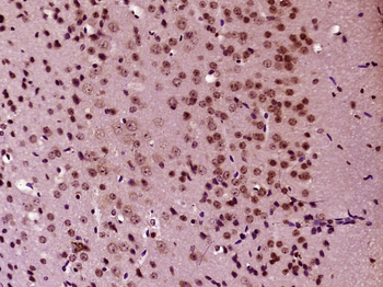 E2F8 Rabbit Polyclonal Antibody