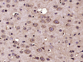 Nucleoporin p62 Rabbit Polyclonal Antibody