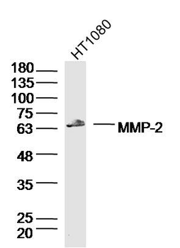 MMP2 Rabbit Polyclonal Antibody