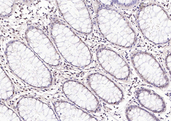 PDGFC Rabbit Polyclonal Antibody