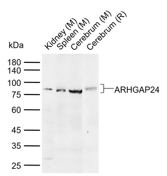 ARHGAP24 Rabbit Polyclonal Antibody