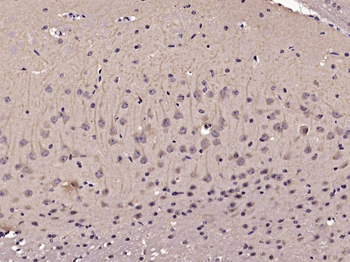 RIPK1 Rabbit Polyclonal Antibody
