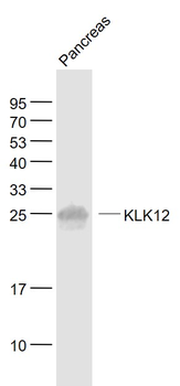 KLK12 Rabbit Polyclonal Antibody