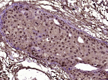 MBD1 Rabbit Polyclonal Antibody
