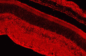 CAMTA1 Rabbit Polyclonal Antibody
