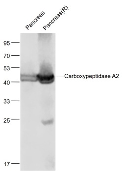 CPA2 antibody
