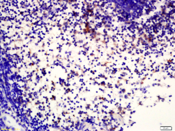 Protein C Rabbit Polyclonal Antibody