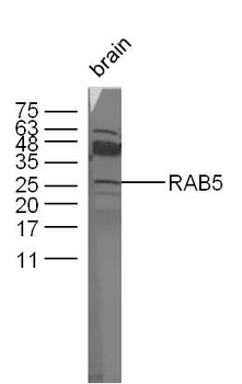 RAB5A Rabbit Polyclonal Antibody