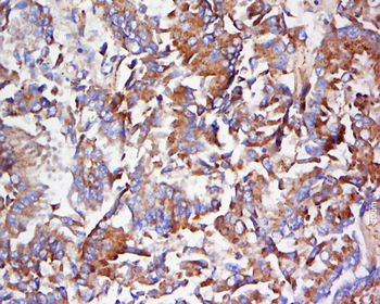 RAB5A Rabbit Polyclonal Antibody