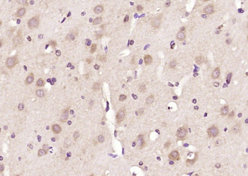 Wnt8b Rabbit Polyclonal Antibody