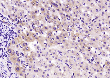 SERPINC1 Rabbit Polyclonal Antibody