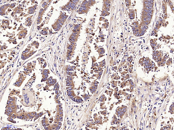 ADM2 Rabbit Polyclonal Antibody