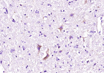 Ryanodine Receptor Rabbit Polyclonal Antibody