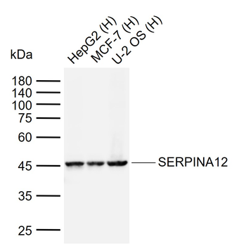 SERPINA12 Rabbit Polyclonal Antibody