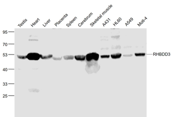 RHBDD3 Rabbit Polyclonal Antibody