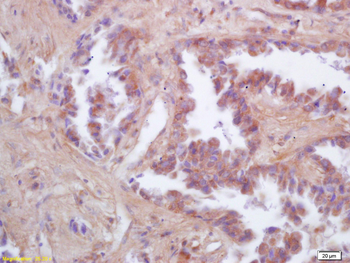 FIS1 Rabbit Polyclonal Antibody