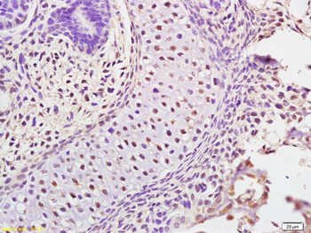 ATAD5 Rabbit Polyclonal Antibody