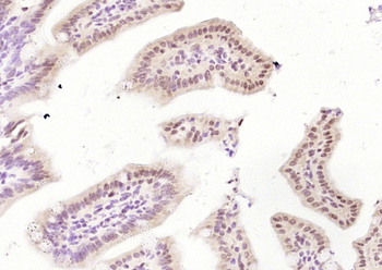 CDCA2 Rabbit Polyclonal Antibody