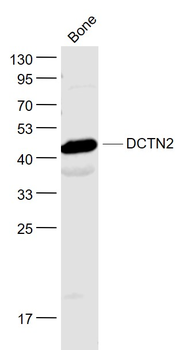 DCTN2 Rabbit Polyclonal Antibody