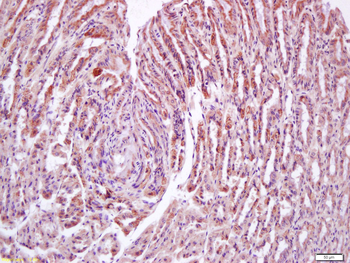 N acetylglucosamine kinase Rabbit Polyclonal Antibody