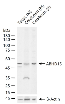 ABHD15 Rabbit Polyclonal Antibody