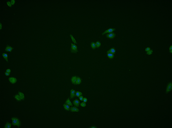 ALDOB Rabbit Polyclonal Antibody