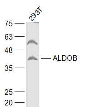 ALDOB Rabbit Polyclonal Antibody