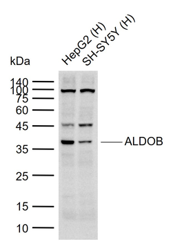 ALDOB Rabbit Polyclonal Antibody