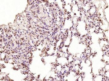 ZNF693 Rabbit Polyclonal Antibody
