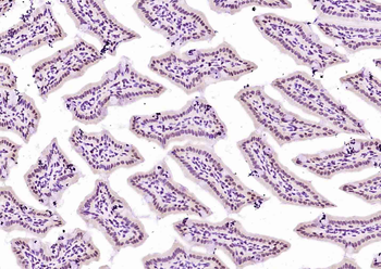 AIM2 Rabbit Polyclonal Antibody