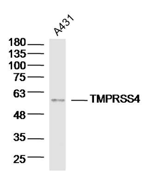 TMPRSS4 Rabbit Polyclonal Antibody