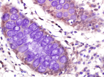 PP2A alpha + beta Rabbit Polyclonal Antibody