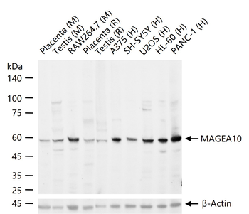 MAGEA10 Rabbit Polyclonal Antibody