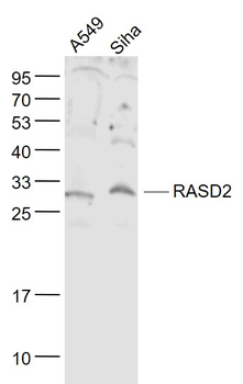 RASD2 Rabbit Polyclonal Antibody