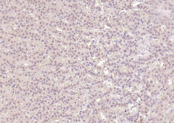 HRPT2 Rabbit Polyclonal Antibody