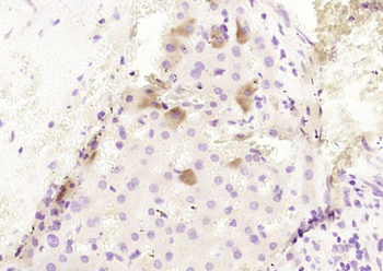 CPB2 Rabbit Polyclonal Antibody