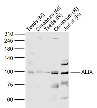 PDCD6IP Rabbit Polyclonal Antibody