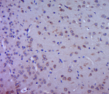 Aromatase Rabbit Polyclonal Antibody
