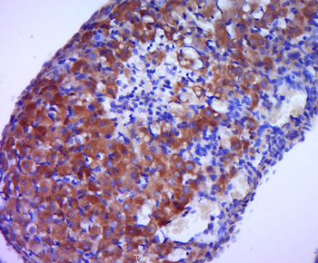 Aromatase Rabbit Polyclonal Antibody