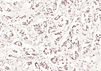 RERE Rabbit Polyclonal Antibody