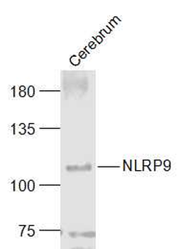 NLRP9 Rabbit Polyclonal Antibody