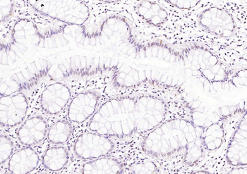 CDCA5 Rabbit Polyclonal Antibody