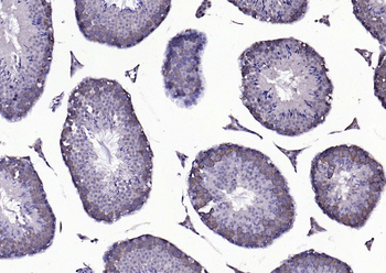 Beta arrestin 2 Rabbit Polyclonal Antibody