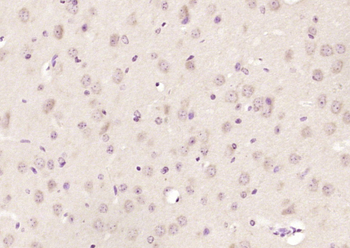 KLHL22 Rabbit Polyclonal Antibody