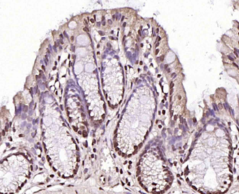 CLK2 Rabbit Polyclonal Antibody