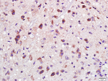 PAK1 Rabbit Polyclonal Antibody