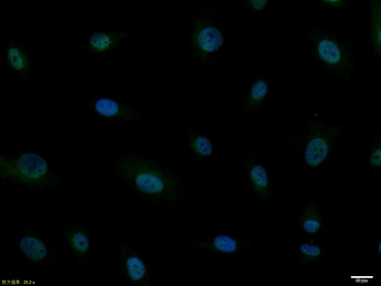 ASCL1 Rabbit Polyclonal Antibody