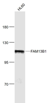 FAM13B1 Rabbit Polyclonal Antibody