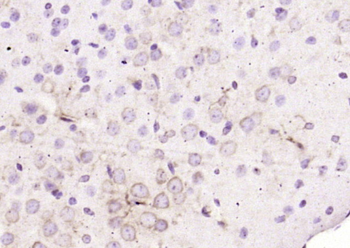 EPDR1 Rabbit Polyclonal Antibody